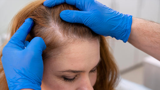 Practical Advice on How to Manage Hair Loss Side Effects